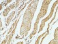 CD79a Polyclonal Antibody